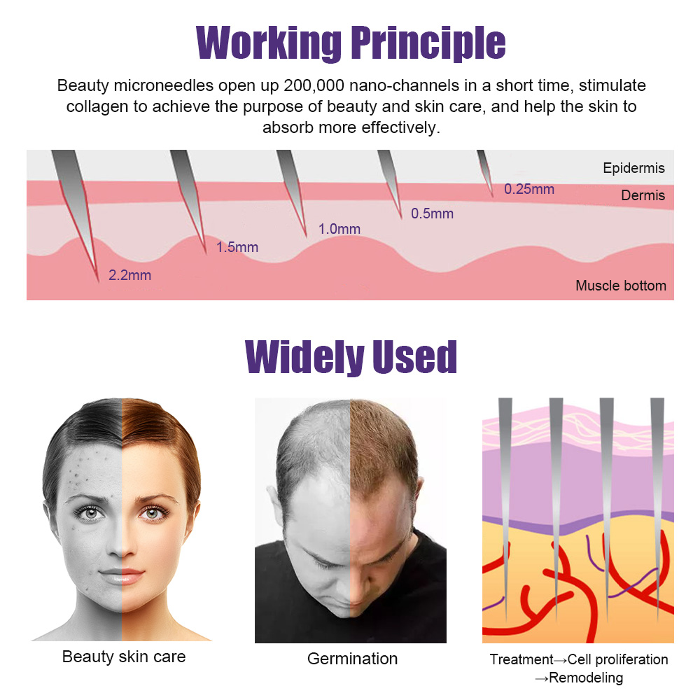 ผู้ชายธรรมชาติ Beard Growth De - Derma Roller 0.25 บทวิจารณ์และราคา