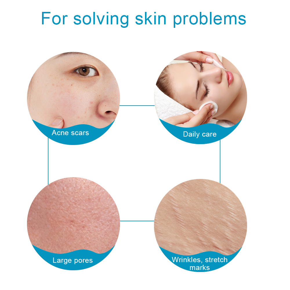1 ชิ้น 540 ไทเทเนียมเดอร์มาโรล - Derma Roller 0.25 บทวิจารณ์และราคา