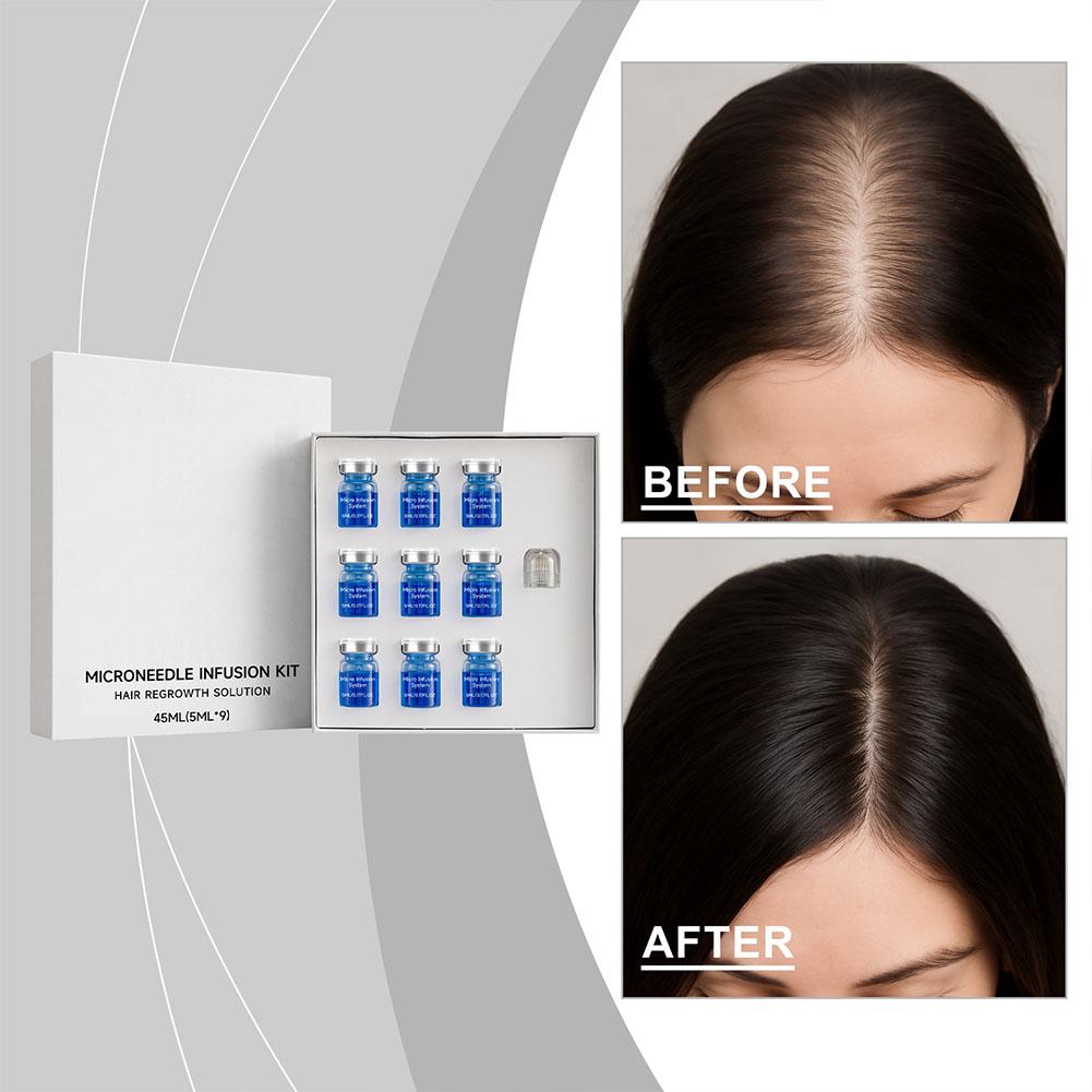 เซรั่มบำรุงเส้นผม 0.25 มม. ชุด - Derma Roller 0.25 บทวิจารณ์และราคา